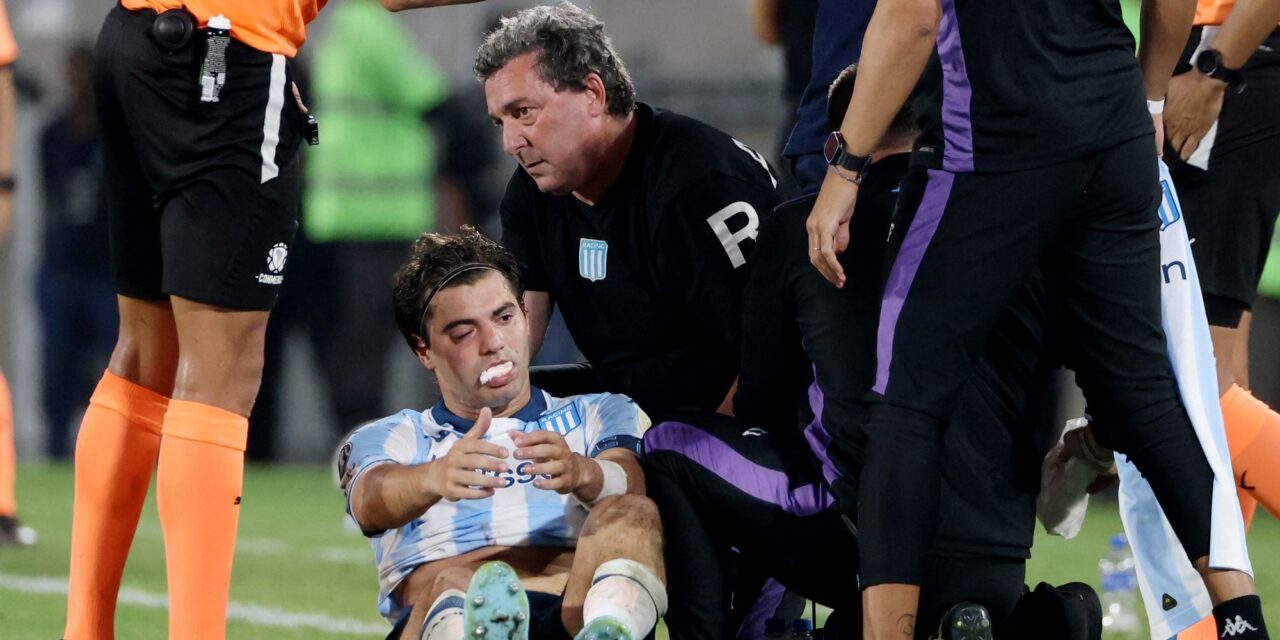 ¡Casi pierde la vista! La increíble recuperación de Santiago Sosa tras un codazo ⚽👀